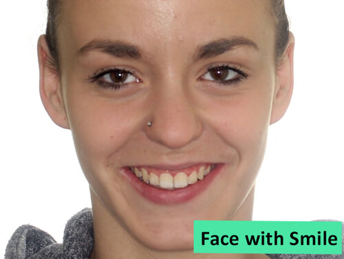 FaceStraightOnWithSmile