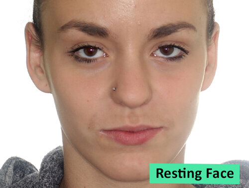 RestingFaceStraightOnNoSmile